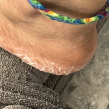 SugarNail - This is after the $40 pedicure. If she'd suggested before about paying a little extra to get rid of the calluses, I would've happily paid. - Nail Salons Near Me - Las Vegas, Nevada