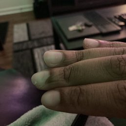 Split nails from a rushed job. Split nails from a rushed job.