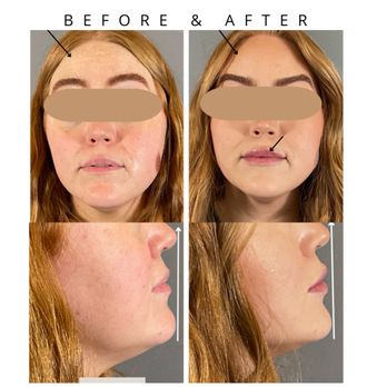 Flawless Skinistry Aesthetics - Facial Balancing - Medical Spas Near Me - Dallas, Texas Flawless Skinistry Aesthetics - Facial Balancing - Medical Spas Near Me - Dallas, Texas