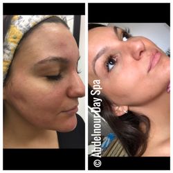 Abdelnour Day Spa