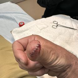 UCHealth Urgent Care - Arvada West - They got me stitched up super fast and couldn't have been nicer while doing it.