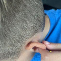 Great Clips - Nicked ear