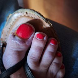 Venetian Nail Spa - Infection my toe.