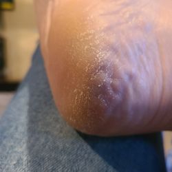 Rose's Nails & Spa - Dry heels that weren't hardly scrubbed. (I get frequent pedi's, it shouldn't look like this)