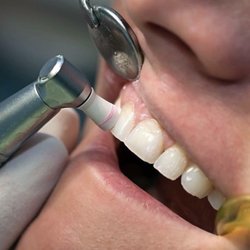 Westview Dental Center and Fastbraces® - At Westview Dental Center and Fastbraces, we believe dental health starts with routine cleanings