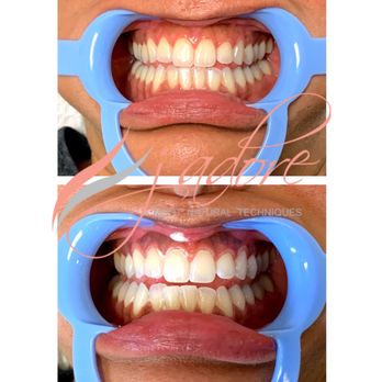 J'adore Clermont - Teeth whitening - Permanent Makeup Near Me - Clermont, Florida
