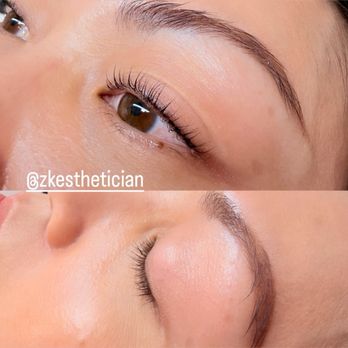 ZK Esthetician - Skin Care Near Me - Tustin, California