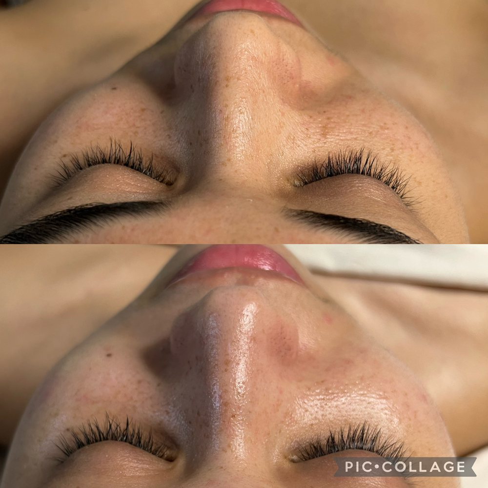 Skins Awakening  Logo