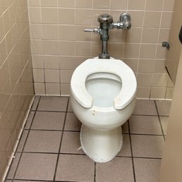 Feces.