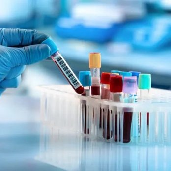 Vitality Phlebotomy Mobile Services - Laboratory Testing Near Me Vitality Phlebotomy Mobile Services - Laboratory Testing Near Me