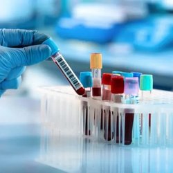 Vitality Phlebotomy Mobile Services