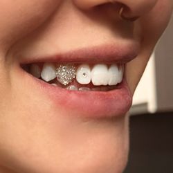 Imagine Esthetics - Fairy dust tooth gems.