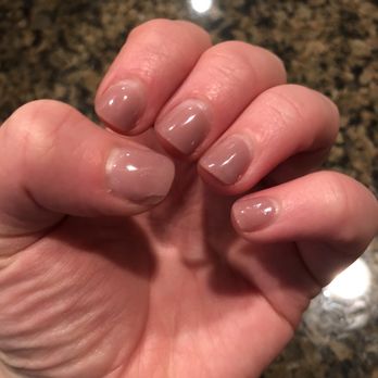 Oasis Nail Spa - Chipped thumb and cracked pinky nail - Nail Salons Near Me - Arlington, Virginia