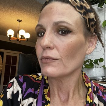 Bare Skin Marin - After 3 treatment .. only face makeup ( tinted BB cream & Bronzer ) - Medical Spas Near Me - Kentfield, California