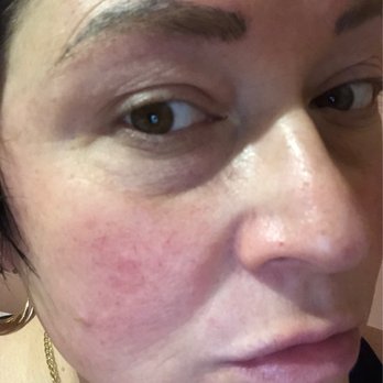 Totally Browtiful Microblading - Mess - Permanent Makeup Near Me - New Hartford, New York Totally Browtiful Microblading - Mess - Permanent Makeup Near Me - New Hartford, New York