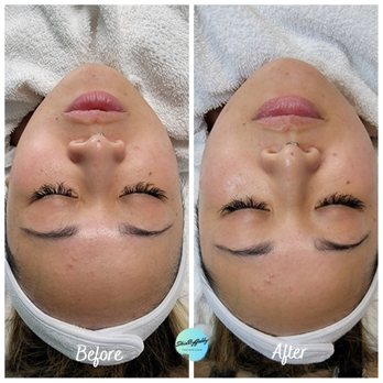 Skin By Gabby - Skin Care Near Me - Upland, California Skin By Gabby - Skin Care Near Me - Upland, California