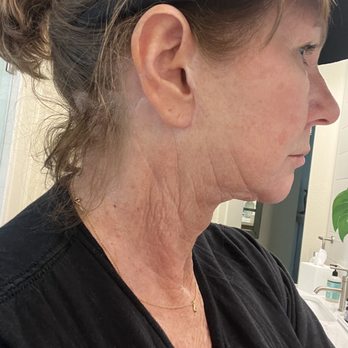 Blackhawk Plastic Surgery & MedSpa - Cosmetic Surgeons Near Me - Danville, California Blackhawk Plastic Surgery & MedSpa - Cosmetic Surgeons Near Me - Danville, California