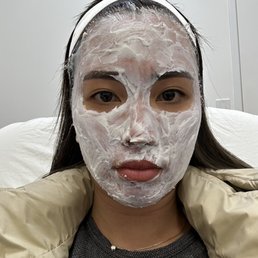 Numbing before clear and brilliant. Be generous, esp near hair lines (that's where it hurts most for me)! Numbing before clear and brilliant. Be generous, esp near hair lines (that's where it hurts most for me)!