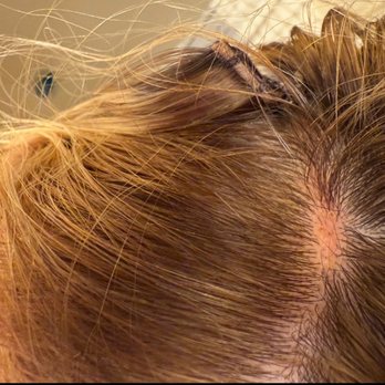 Wicked Scissors - Bald spot due to extension - Hair Salons Near Me - Fortville, Indiana Wicked Scissors - Bald spot due to extension - Hair Salons Near Me - Fortville, Indiana