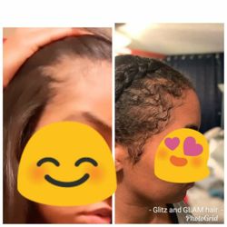 Glitz and Glam Hair Studio - Results using our all natural ingredient EDGE FORMATION Hair Growth Balm