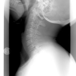 Power of Life Chiropractic - Can you see the problem here? We can check you over, diagnose, and get you relief without the cost of X-Rays! Call Today To Schedule!