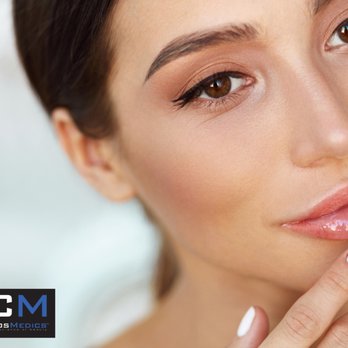 CosMedics - #lips #botox #fillers - Skin Care Near Me - Edmonton, Alberta