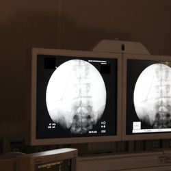 ReVive Orthopedics - Fluoroscope photos