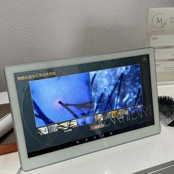M Head Spa - My daughter's dandruff before (right) and after (left). - Hair Loss Centers Near Me - Rosemead, California M Head Spa - My daughter's dandruff before (right) and after (left). - Hair Loss Centers Near Me - Rosemead, California