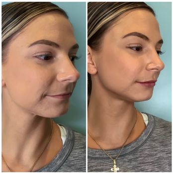 Basis Aesthetics - Medical Spas Near Me - Delray Beach, Florida
