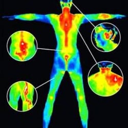 Vista Natural Wellness Center - Thermography is a non-invasive imaging procedure for monitoring physical conditions by showing thermal changes present in the body.