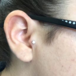 Right Tragus Right Tragus