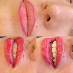 Eternity Beauty Care - Lip blush