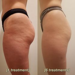 Wholistic Space - Start today!  Call for a free consultation appointment!!!