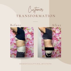 Side profile of my Post Op client