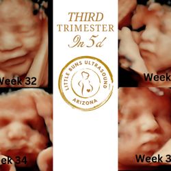 Little Buns Ultrasound & Baby Boutique - Come to little buns and let us capture the joy of your bun in the oven with stunning 5D prenatal Ultrasound