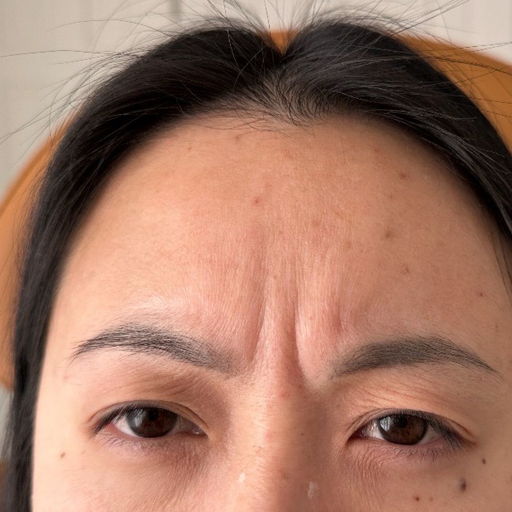 Enaira Medical Aesthetics - Deep 11s - Medical Spas Near Me - Vallejo, California Enaira Medical Aesthetics - Deep 11s - Medical Spas Near Me - Vallejo, California