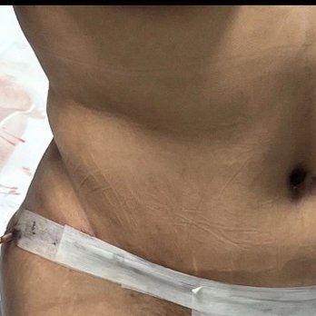 Nip Tuck Aesthetics - Plastic Surgeons Near Me - Miami, Florida Nip Tuck Aesthetics - Plastic Surgeons Near Me - Miami, Florida