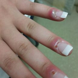 This the staph infection cc you gave to my granddaughter