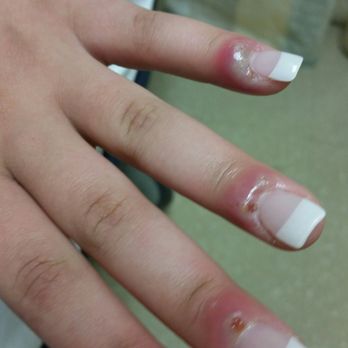 CC You Day Spa - This the staph infection cc you gave to my granddaughter - Nail Salons Near Me - Conway, South Carolina