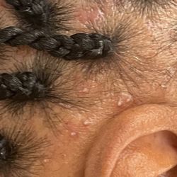 Binta Africa Hair Braiding - More bumps from being too tight