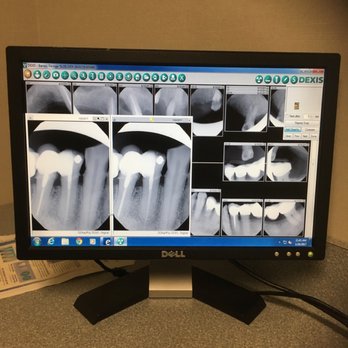 Caplin Harvey ,DDS - This is a picture of the work that had to be done. - General Dentistry Near Me - Hauppauge, New York Caplin Harvey ,DDS - This is a picture of the work that had to be done. - General Dentistry Near Me - Hauppauge, New York