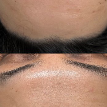 Earnest Esthetics - Anti-aging - Estheticians Near Me - San Mateo, California Earnest Esthetics - Anti-aging - Estheticians Near Me - San Mateo, California