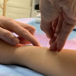 Situ Healing - Acupuncture