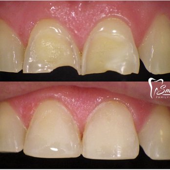 Smith Dental - Cosmetic Dentists Near Me - Mission, Texas