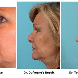 Craig R. Dufresne, MD, FACS