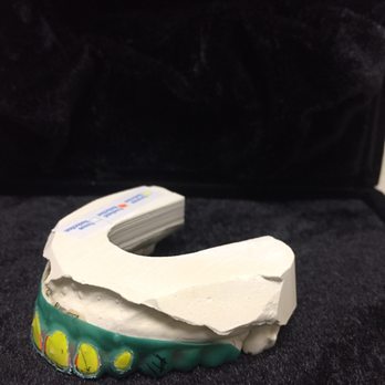 Haris Hashimi - Methodical way of doing smile make over - General Dentistry Near Me - Riverside, California Haris Hashimi - Methodical way of doing smile make over - General Dentistry Near Me - Riverside, California
