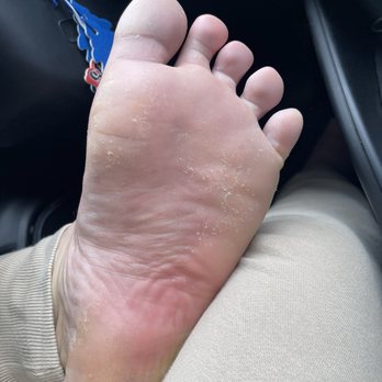 Bee Nails & Spa - Husbands bottom of foot - Nail Salons Near Me - Riverside, California
