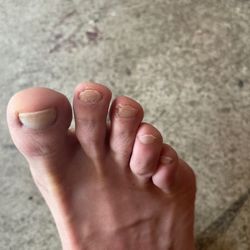 Luxury Nails and Spa - My poor toe nails.