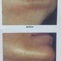 New Image Laser