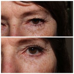Tampa Bay Cosmetic Surgery Center